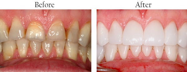 Syosset dental images