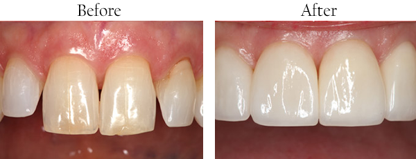 Plainview dental images