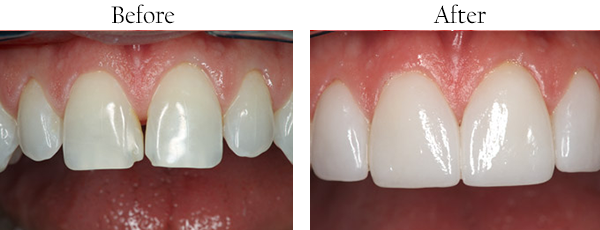 dental images 11803